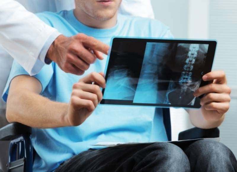 La esclerosis múltiple presenta desafíos sustanciales para los sistemas de salud de América Latina