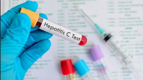 El Gobierno incluirá el testeo de hepatitis C en el carnet de salud