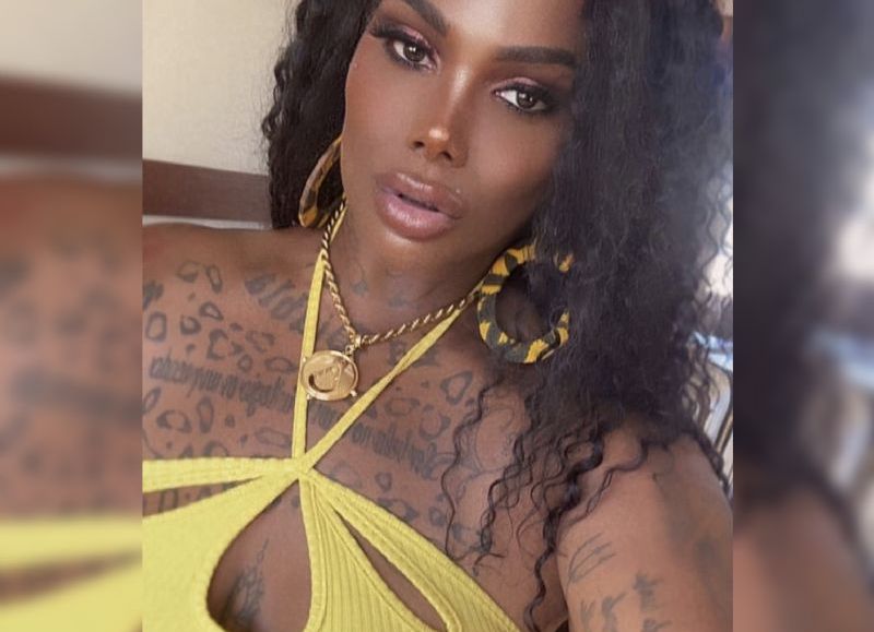 VIDEO | Grave denuncia de Rihanna Martínez: nódulos malignos, metacrilato y un cirujano señalado que sigue operando